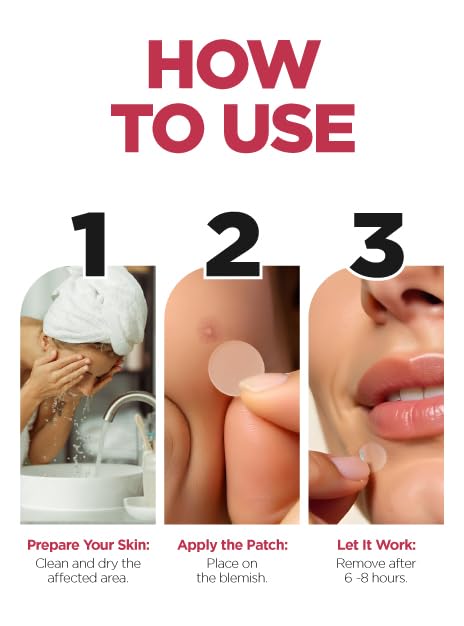 Pavari Acne Patches - Transparent Pimple Patch for Face |Treatment for Zits and Blemishes | Hydrocolloid Acne Patch | Breakout Spot Treatment | (36 Count)