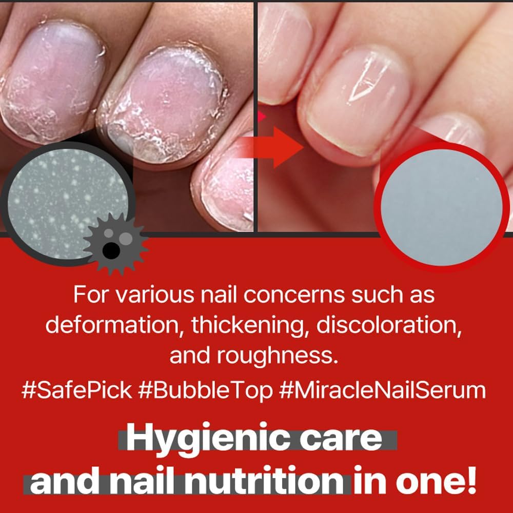 Safepick Miracle Nail Serum Nail Strengthener | Clear & Opaque Crème Nail Polish Treatment | Strengthen Weak & Thin Nails