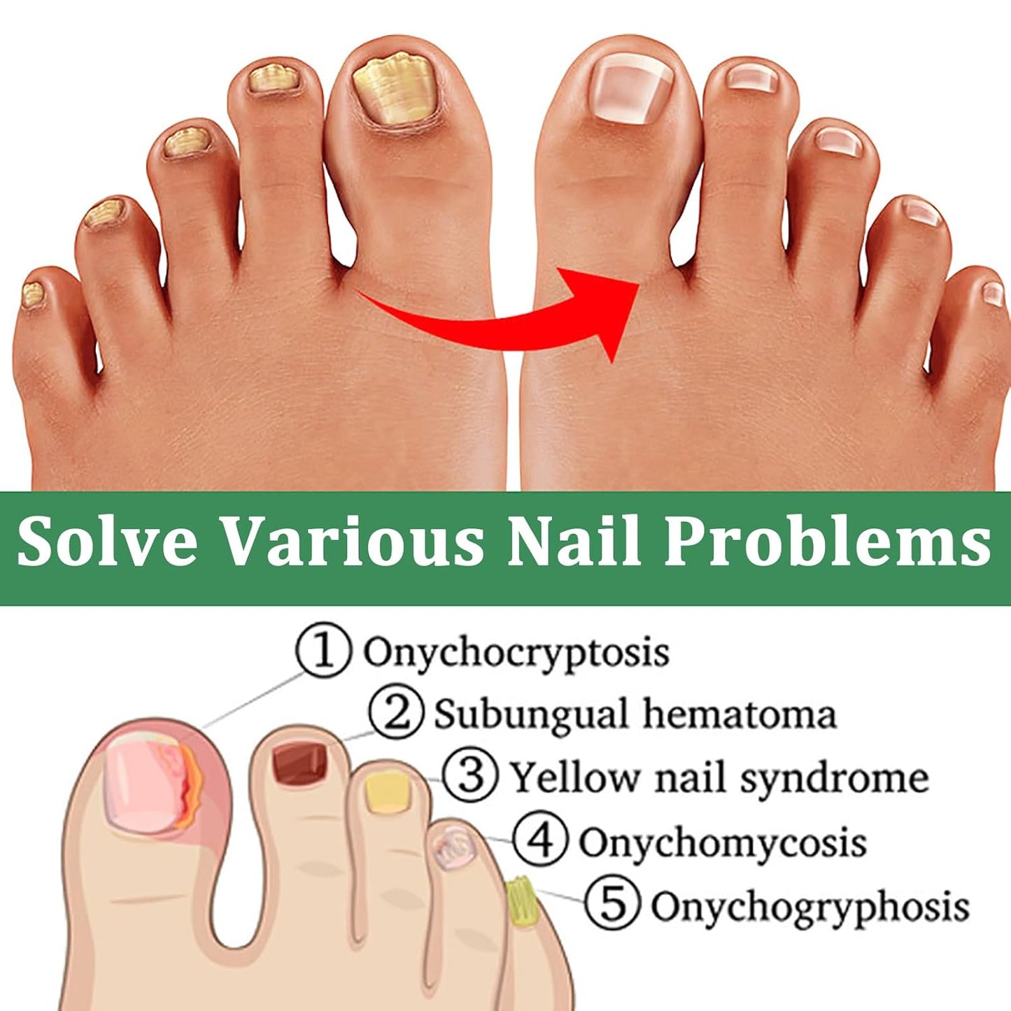 Nutraboost Nail Treatment Gel, Nail Growth Serum for Repair & Strengthener, Multi-Purpose Nail Repair Serum (3)