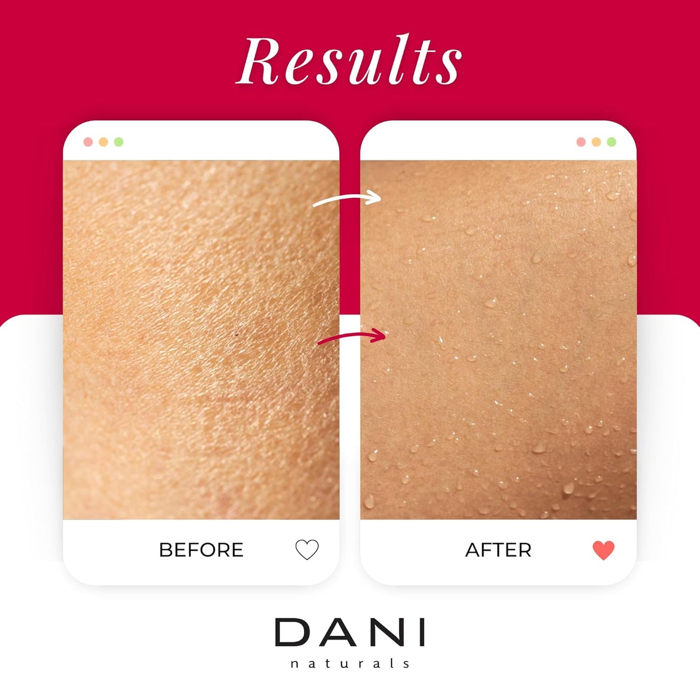 Naturals Exfoliating Sugar Scrub - Citrus Rose - Organic Cane Sugar & Shea Butter - Deep Hydration & Gentle Exfoliation for Smooth, Radiant Skin - 14 oz