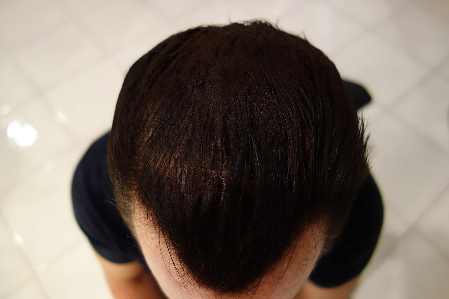 Finally Hair Building Fiber Refill 100 Grams Dark Grey Hair Loss Concealing by Finally Hair (Dark Gray)