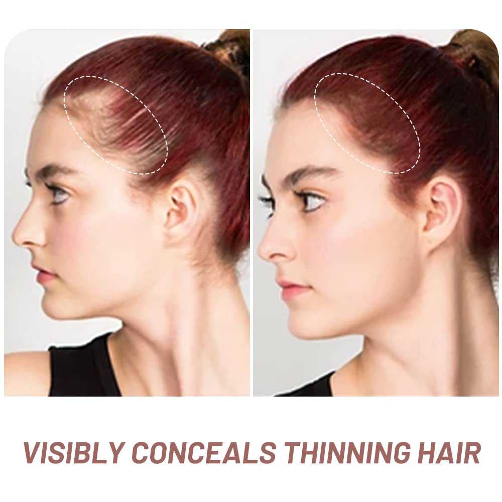 Root Touch Up Hair Powder, Instantly Gray Hair Root Cover Up Hairline Powder, Hair Concealer For Women and Men (A-Red Brown, 2PC)