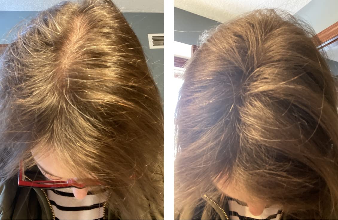 Caboki Hair Loss Concealer. All-Natural Hair Building Fiber. Make Thin Hair Look 10X Fuller Instantly. Eliminate the Appearance of Bald Spot and Thinning Hair (30G, 90-Day Supply). BLONDE