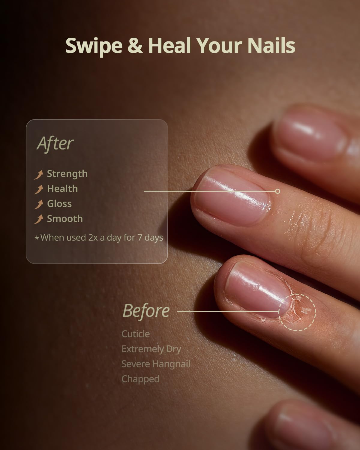 BTARTBOXNAILS Nutri-Forte Cuticle Oil - Pure Oil Formula with Olive Oil, Vitamin E, Squalane, Deep Repairing & Nourishing & Strengthening Treatment for Severe Nail Concerns, 15ml