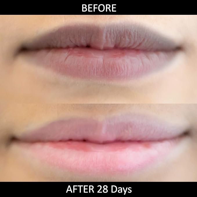 Omorfee 100% Organic Lip Lightening Balm, balm for Dark Lips, Balm with SPF, Natural Protection, Repair, Moisturizer, Cocoa Butter, Carrot Seed Oil & Pineapple Extract -10g/ 0.35Oz