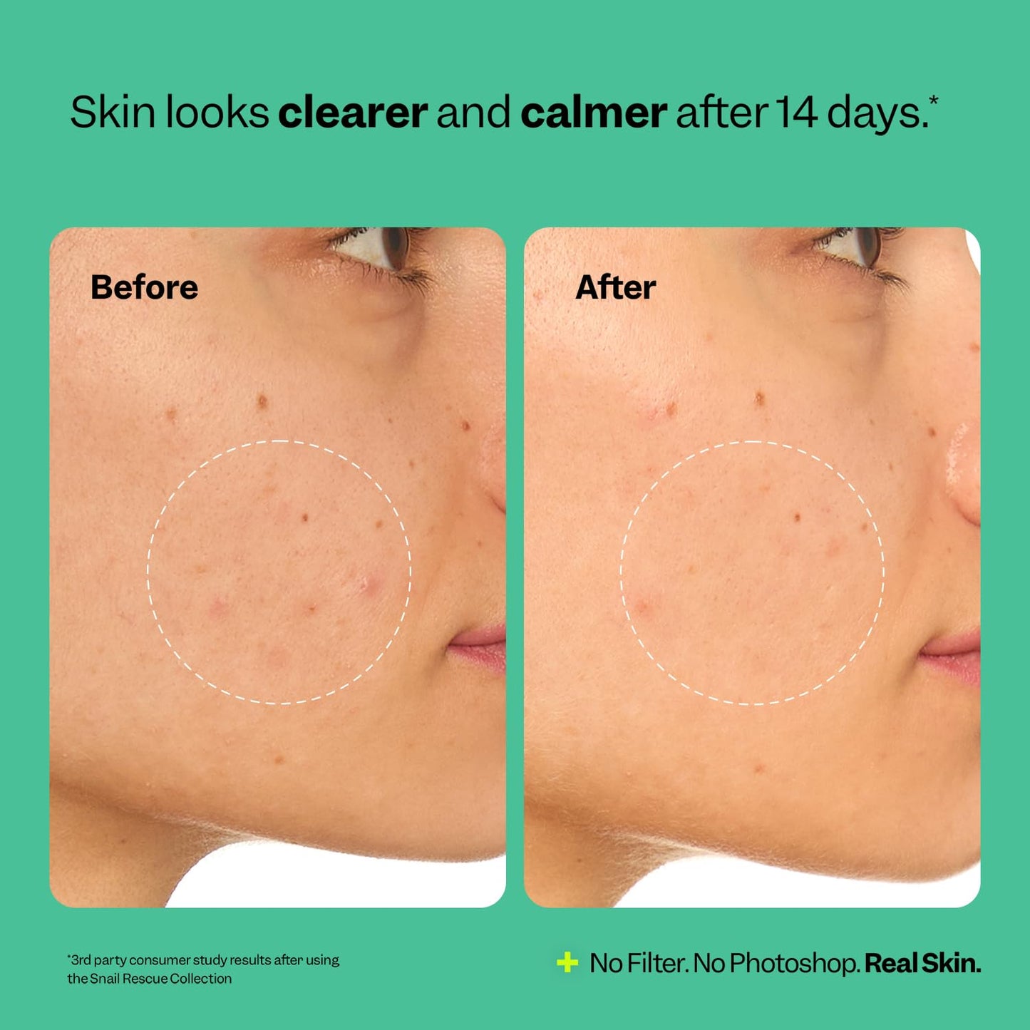 Peach Slices | Snail Rescue Intensive Treatment Wash-Off Face Mask | 95% Snail Mucin | For Dark Spots & Blemishes | Refreshing & Calming Mask | Clear, Radiant, & Hydrated Skin | Skin Care | 3.38 oz