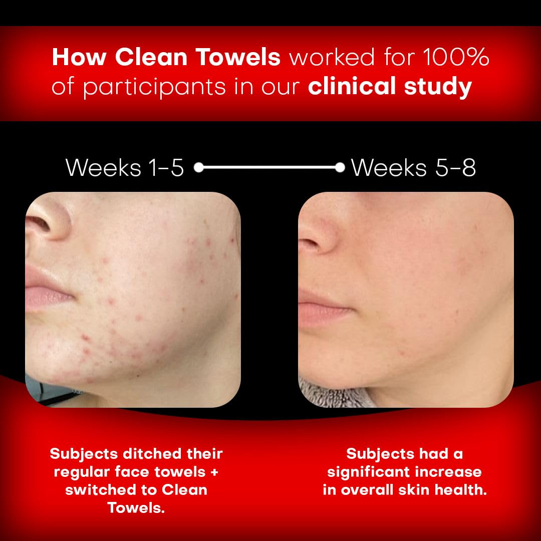 Face Towels | XL 8x8 Ultra Soft & Extra Thick Facial Wipes | Disposable Face Towelettes for Sensitive Skin | Dry Face Cloths for Makeup Remover, Travel & Skincare | 60 count