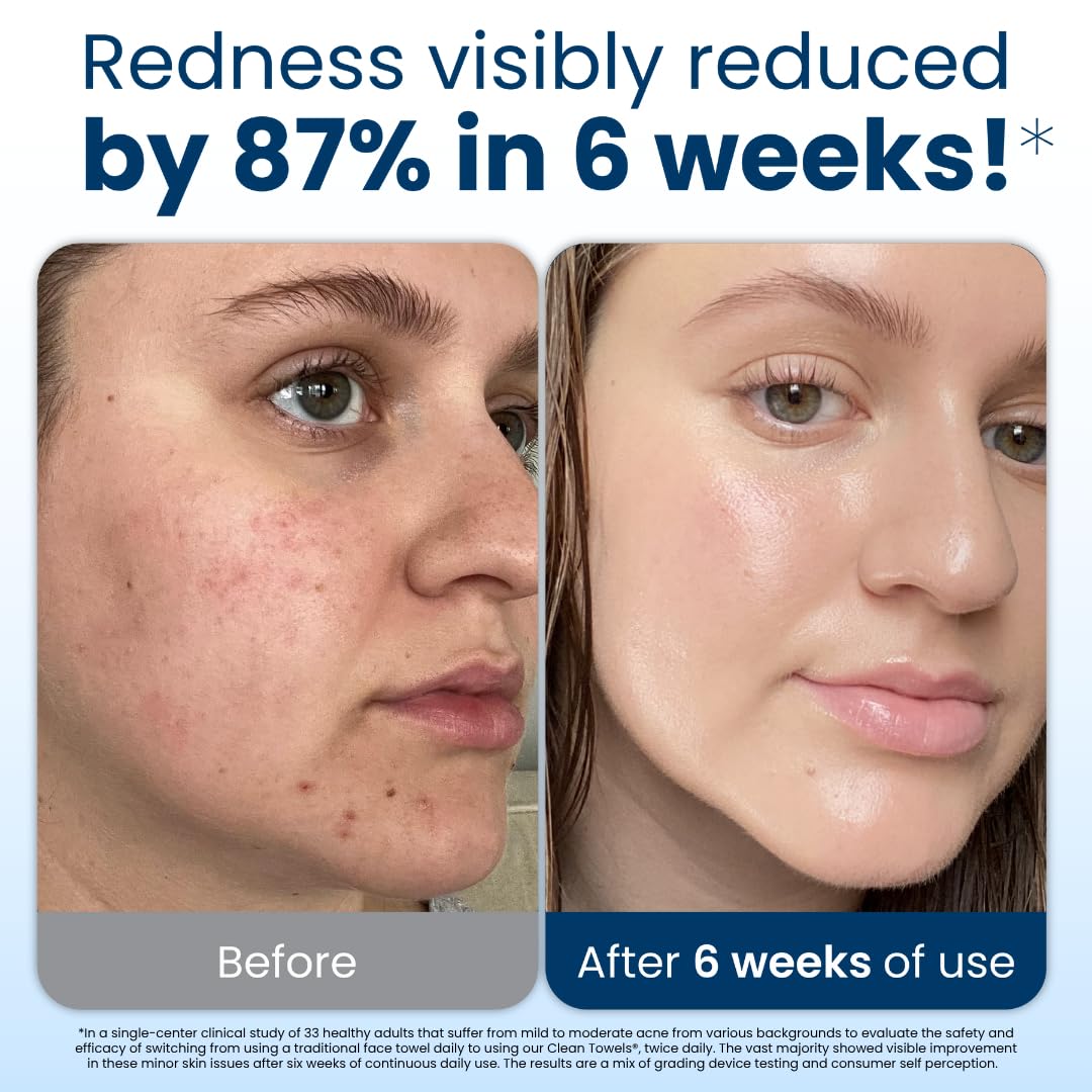 Clean Skin Club Clean Towels XL®, 100% USDA Biobased Face Towel, Disposable Face Towelette, Eczema Association Accepted, Makeup Remover Dry Wipes, Ultra Soft, 50 ct per pack, 3 Packs, 150 Ct Total