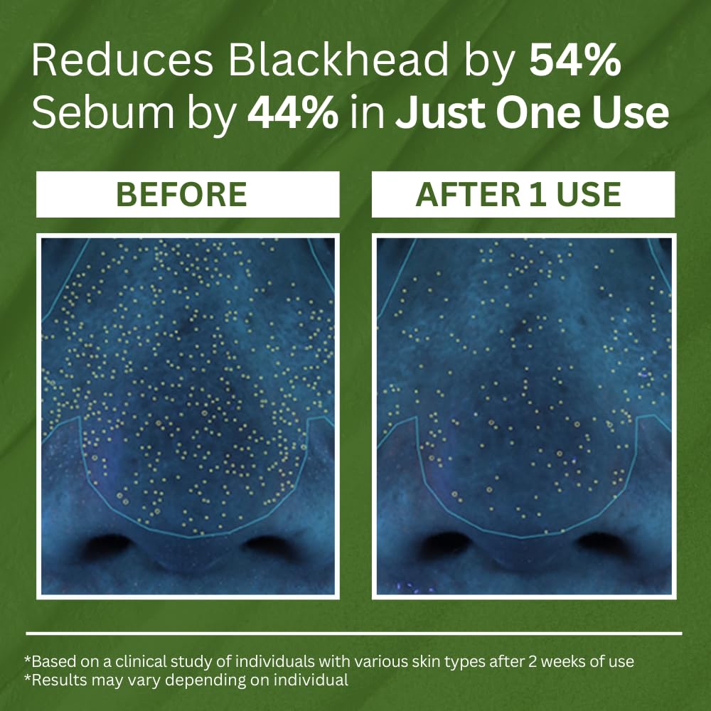 P.CALM Holy Basil Bubble Deep Mask – Holy Basil & Carbonated Water for Cleansing Pores & Blackheads, Korean Clay to Bubble Wash-Off Pack (90g / 3.17 oz)