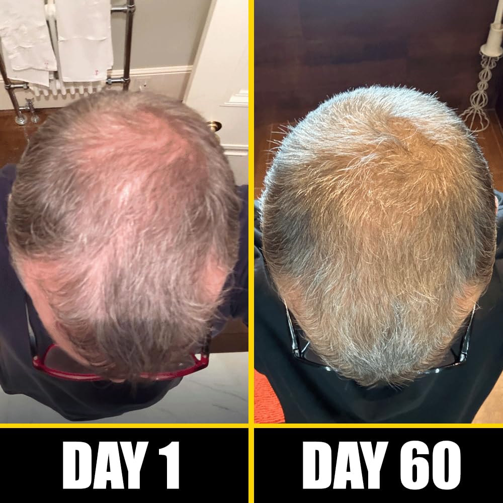 Pete & Pedro BOOST Hair & Beard Growth Serum Strengthening Oil For Men & Women - With Rosemary, Biotin & 20+ Natural Essential Oils | Shark Tank Featured, 2 oz.