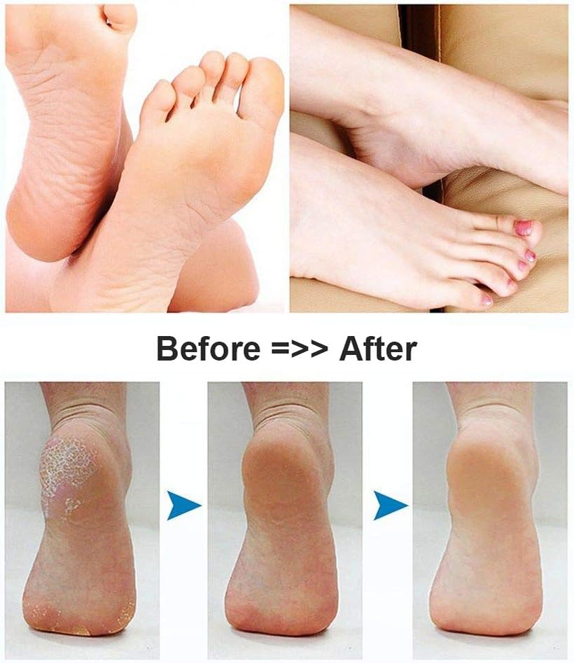 BOMPOW Foot Scrubber Electric Callus Remover Rechargeable Foot File Hard Skin Remover Pedicure Tools Electronic Callus kit for Cracked Heels and Dead Skin with 2 Roller Heads, Blue