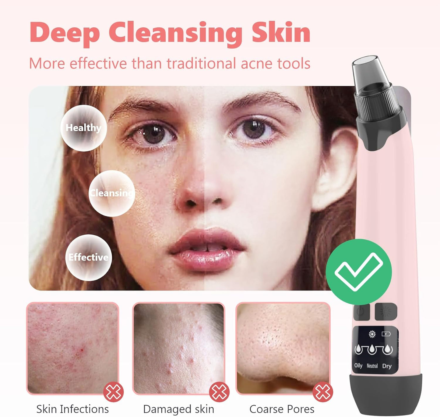 Blackhead Remover Vacuum - Black Head Remover for Face,Blackhead Extractor Tool with 3 Adjustable Suction Levels,4 Probes,USB Interface Type Pore Vacuum,Suitable for Women and Men (Pink)