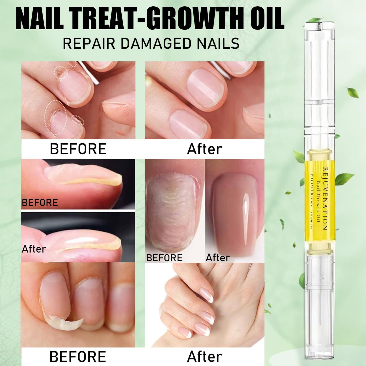 Rejuvenation Nail Growth Oil, Nail Oil For Growth And Strength Rejuvenation (2pc)