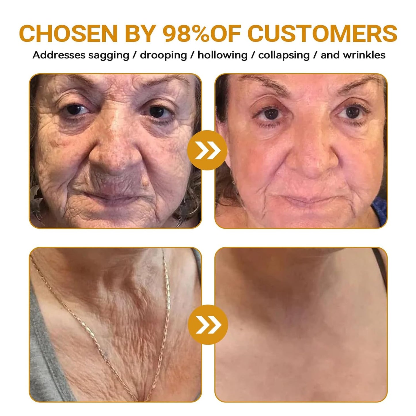 LipMaps Bee Venom Skin Restoration Cream, Bee Venom Skin Treatment Cream, Repair skin and Firming, Effective In Reducing Blemishes (1)