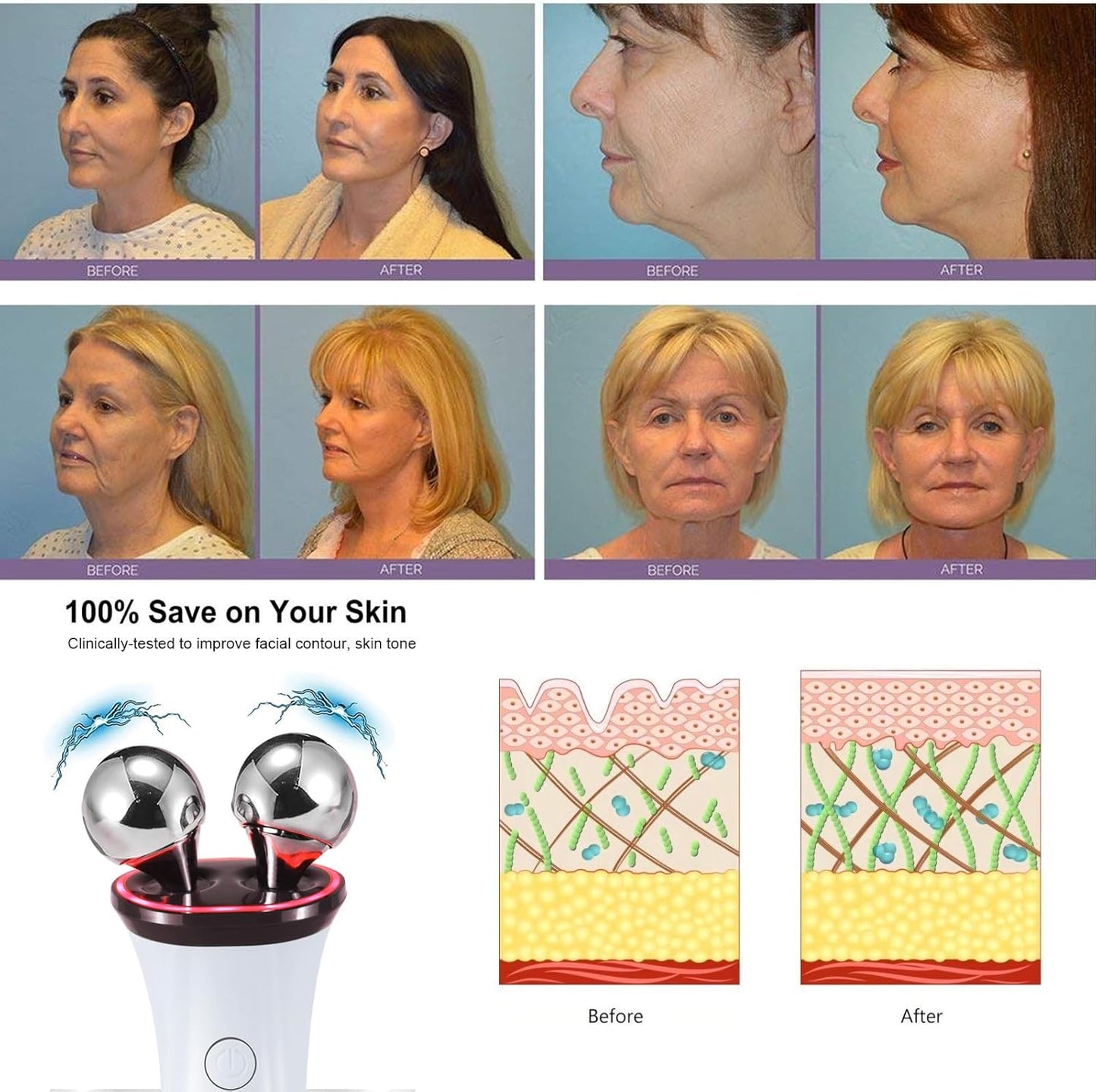 Microcurrent Facial Device - Electric Face Lifting & Toning for Face & Neck for Mother & Companion - Handheld Skin Care Device (White)