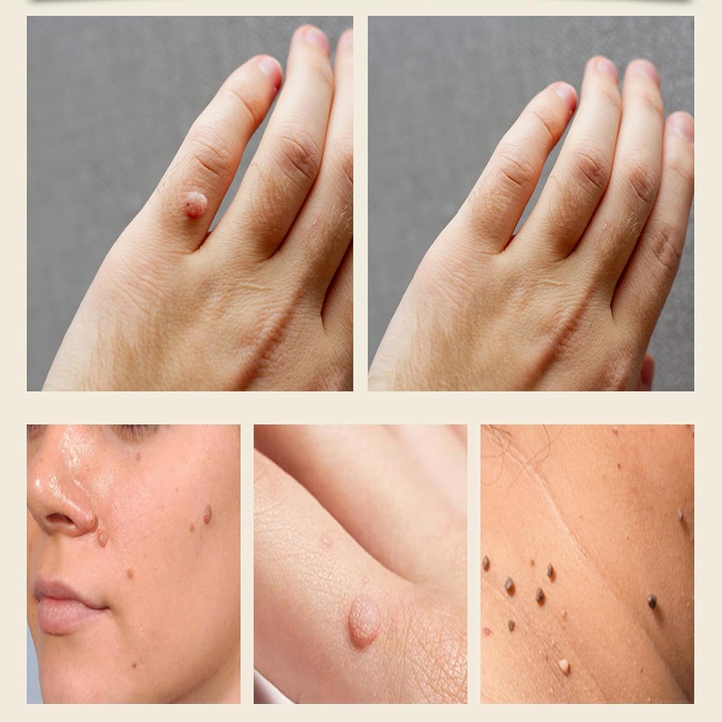 Bee Venom Skin Treatment Cream, Bee Venom Repair Cream, Suitable for All Skin Types