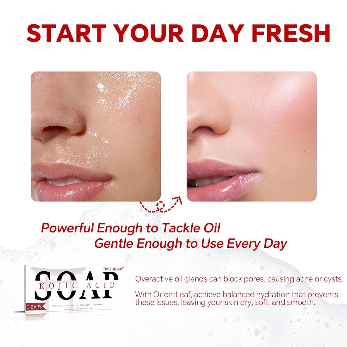 Kojic Acid Soap, Turmeric Soap Bar for Dark Spots, Fresh Citurs Scent, Gentle for Face and Body Wash with Vitamin C, Shea Butter, Retinol, Olive Oil, Collagen (3 PACK)