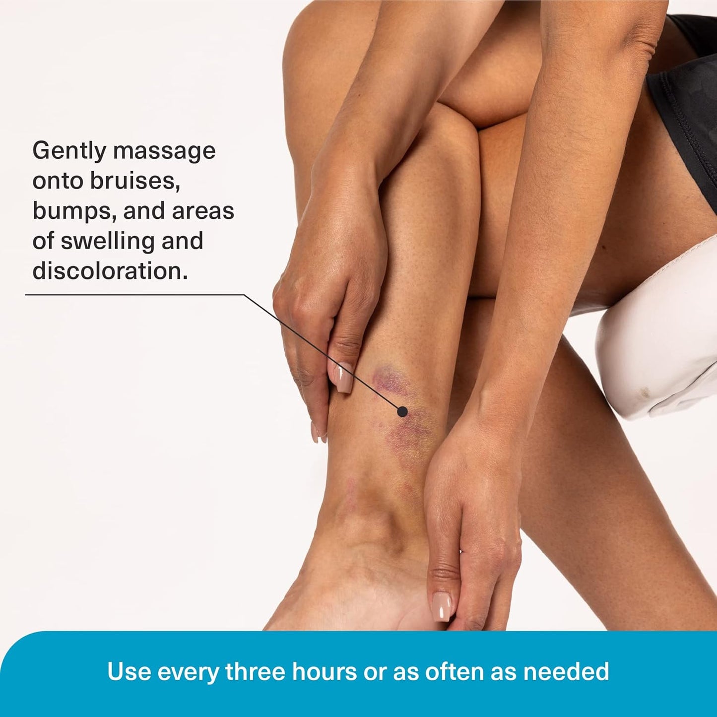 Arnica Bruise Relief Lotion for Bruising, Swelling, & Discoloration On Skin, Natural Skin Care Arnica Bruise Homeopathic Topical Bruise Cream W/Aloe Vera & Collagen, 4 Fl Oz (Pack of 2)