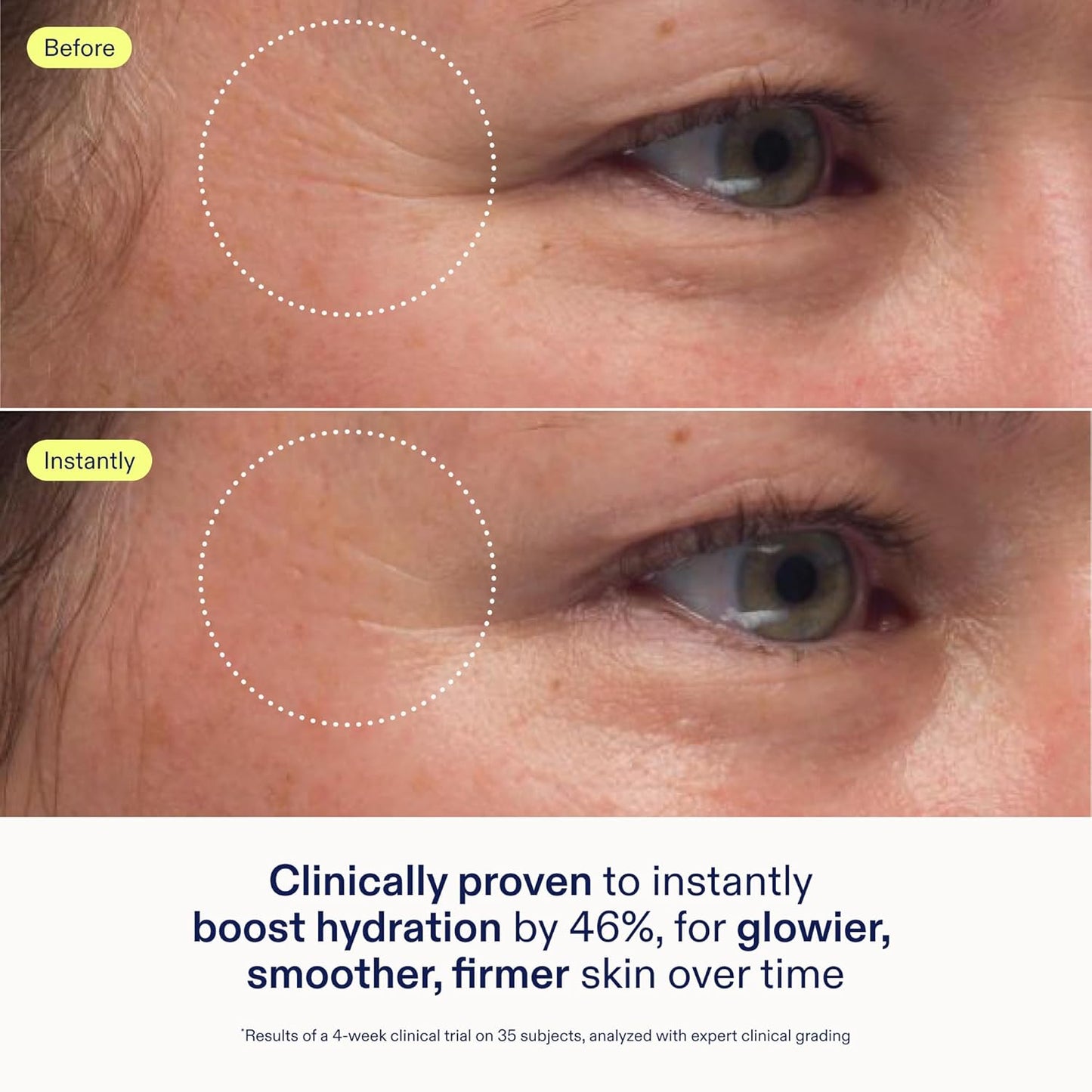 Skinfix Triple Lipid-Peptide Cream - 1.7 oz - Rich Face Moisturizer to Instantly Hydrate & Restore Dry, Sensitive Skin - Non-Comedogenic, Fragrance Free, Vegan, Cruelty Free