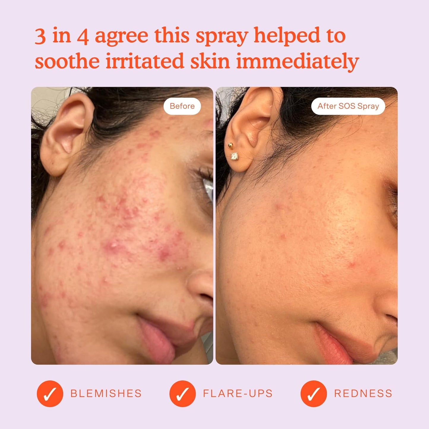 Tower 28 SOS Daily Rescue Facial Spray for Sensitive Skin, Hypochlorous Acid Spray Helps Reduce Redness and Breakouts, Full Size Toner for Face, 4 FL Oz