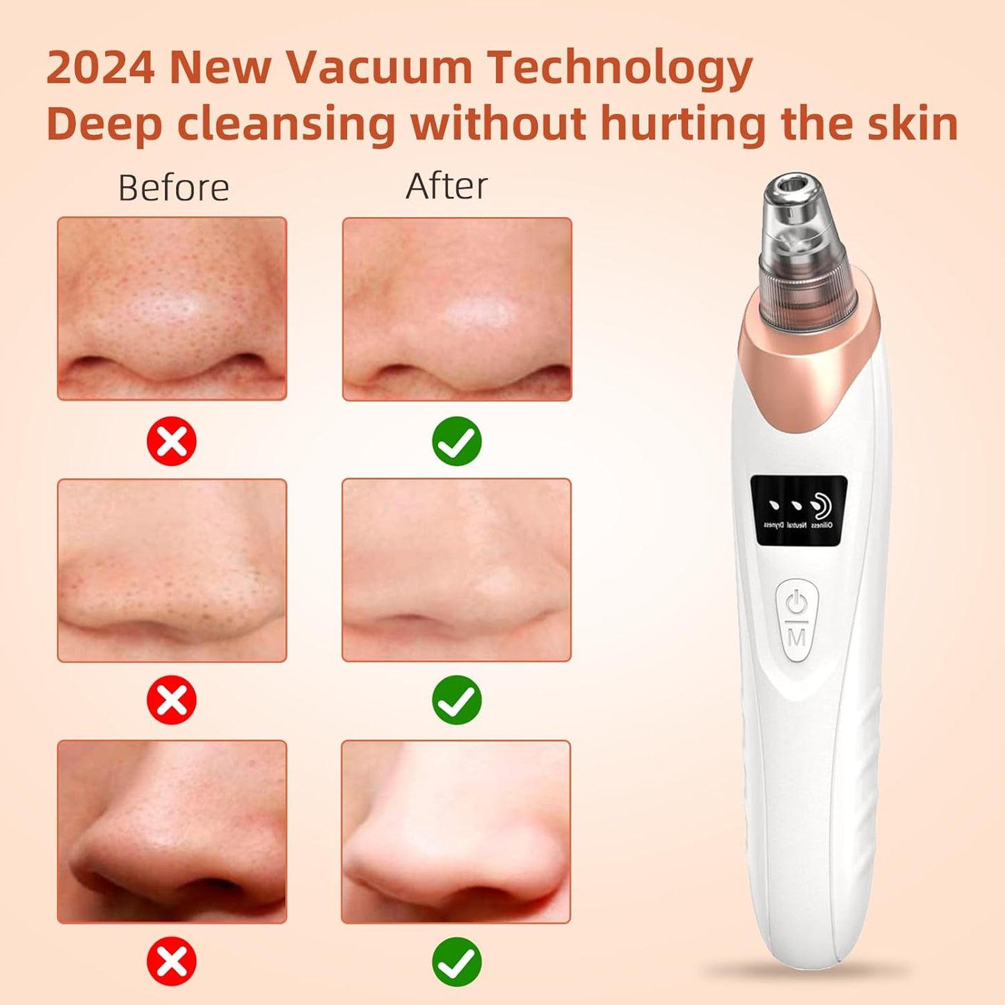 2025 Pore Vacuum, USB Rechargeable Blackhead Remover Vacuum,3 Levels Adjustable Pore Vacuum Blackhead Remover, with 5 Suction Power,6 Probes,Face Vacuum Pore Cleanser for Women & Men-White