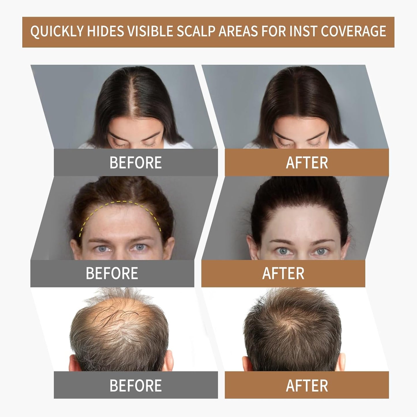 Sevich Hairline Powder 2.0，Instantly Conceals Hair Loss, Root Touch up Powder, Hair Shadow Toppers for Women & Men Thinning Gray Hair, Windproof & Sweatproof, 48H Makeup Lasting, Medium brown