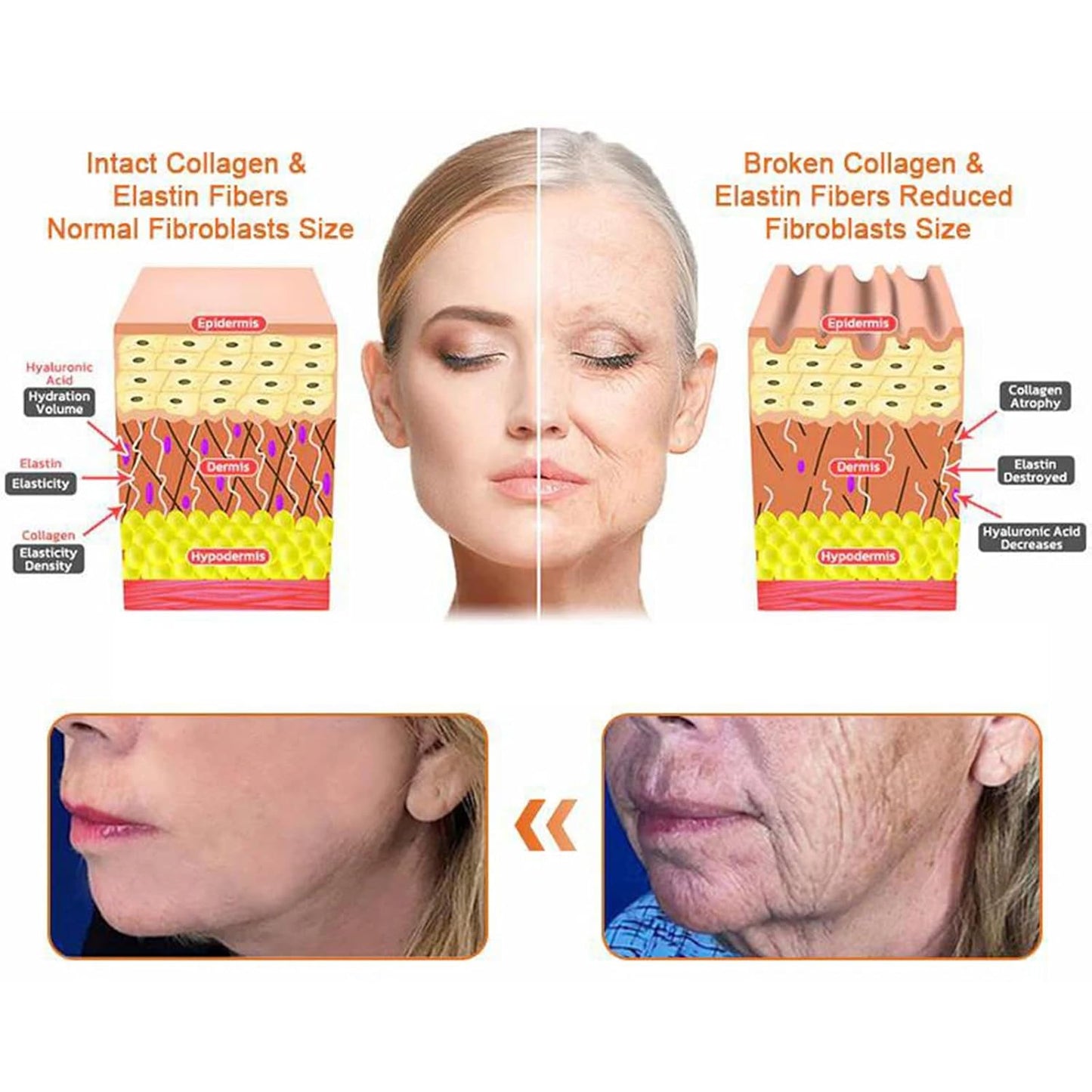 Bee Venom Comprehensive Cream, Professional bee venom cream for Removing and Repair, APKAPK Bee Venom Skin Treatment Cream, Natural Serum Suitable for All Skin Types (2 Pack)