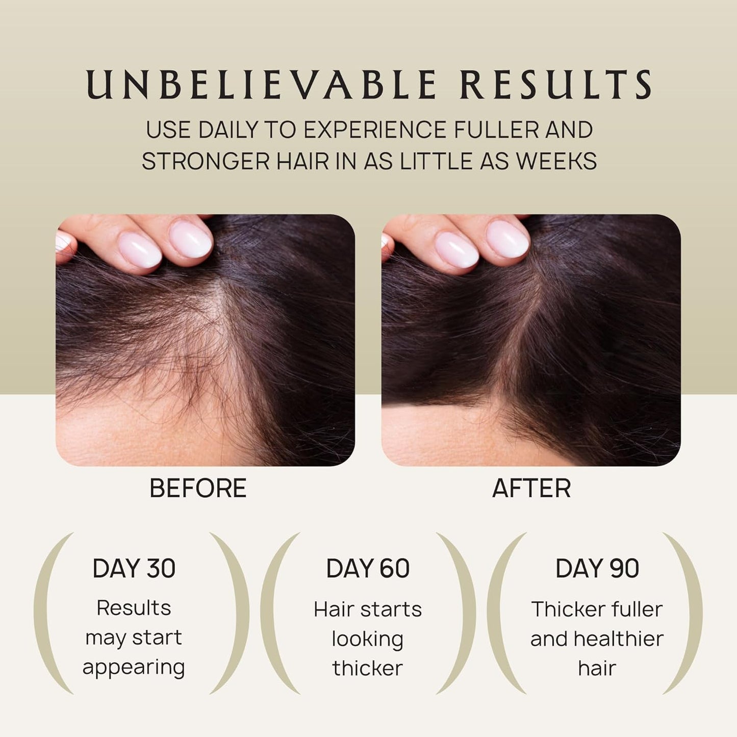 Hair Growth Oil Spray - 100% Pure Ingredients For Non Greasy, Thicker & Stronger Hair - Organic Batana, Castor, Biotin, Saw Palmetto, and Rosemary Oil for Men & Women Scalp - 4.1 Fl Oz