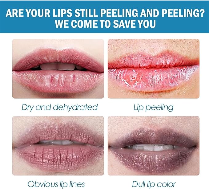 2pcs Lip Lightening for Dark Lips Lip Brightener for Smokers Dark Lip Treatment Lightening Cream for Pink Lips Lip Lightener for Smoker Lips Lip Lightening balm for Men and Women (Orange)