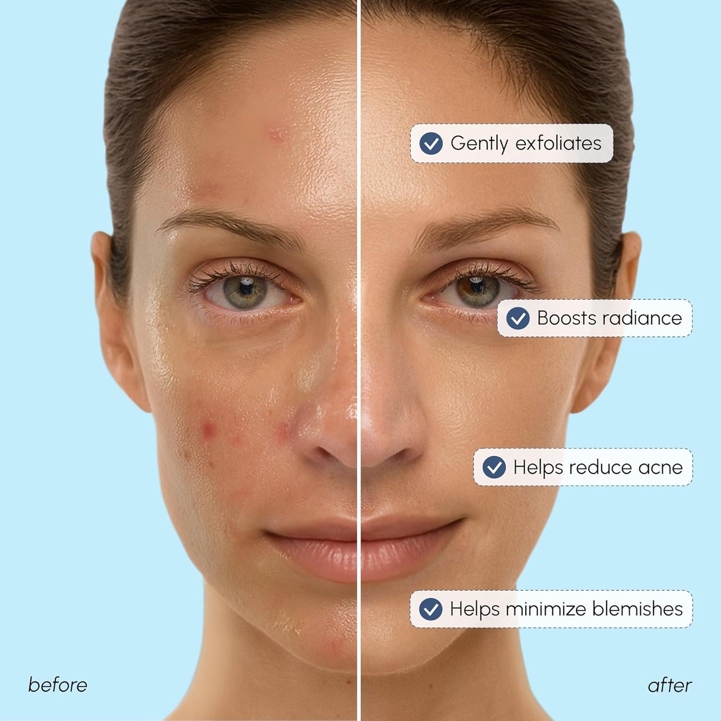 MAREE Glycolic Acid Toner 10% Facial Polish - Exfoliating Toner for Face - Glycolic Acid Toning Solution - Face, Scalp & Underarms Exfoliant Spray Alternative - Pure Acido Glicolico para Manchas