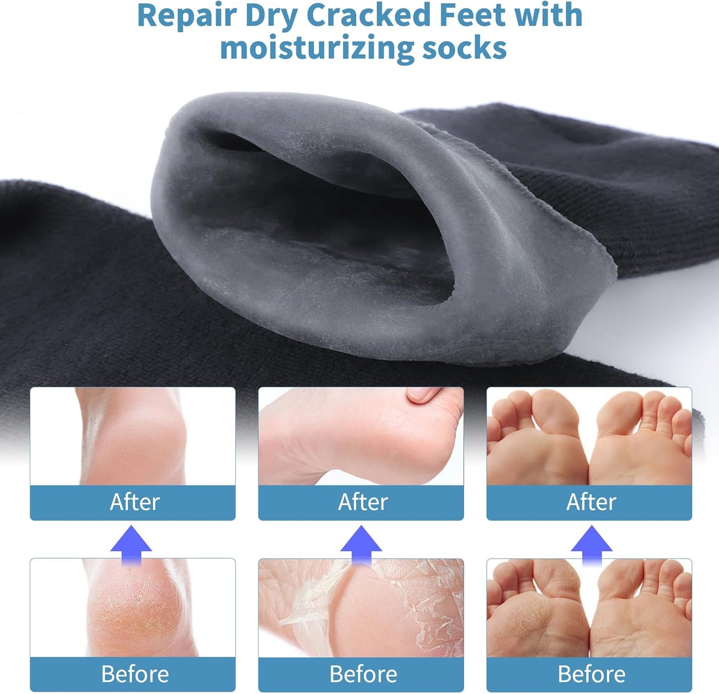 Large Silicone Moisturizing Socks for Men - 1 Pair Soft Foot Care Socks - 11“ Large Size Feet Moisturizing Socks for Dry Cracked Feet (Size L)