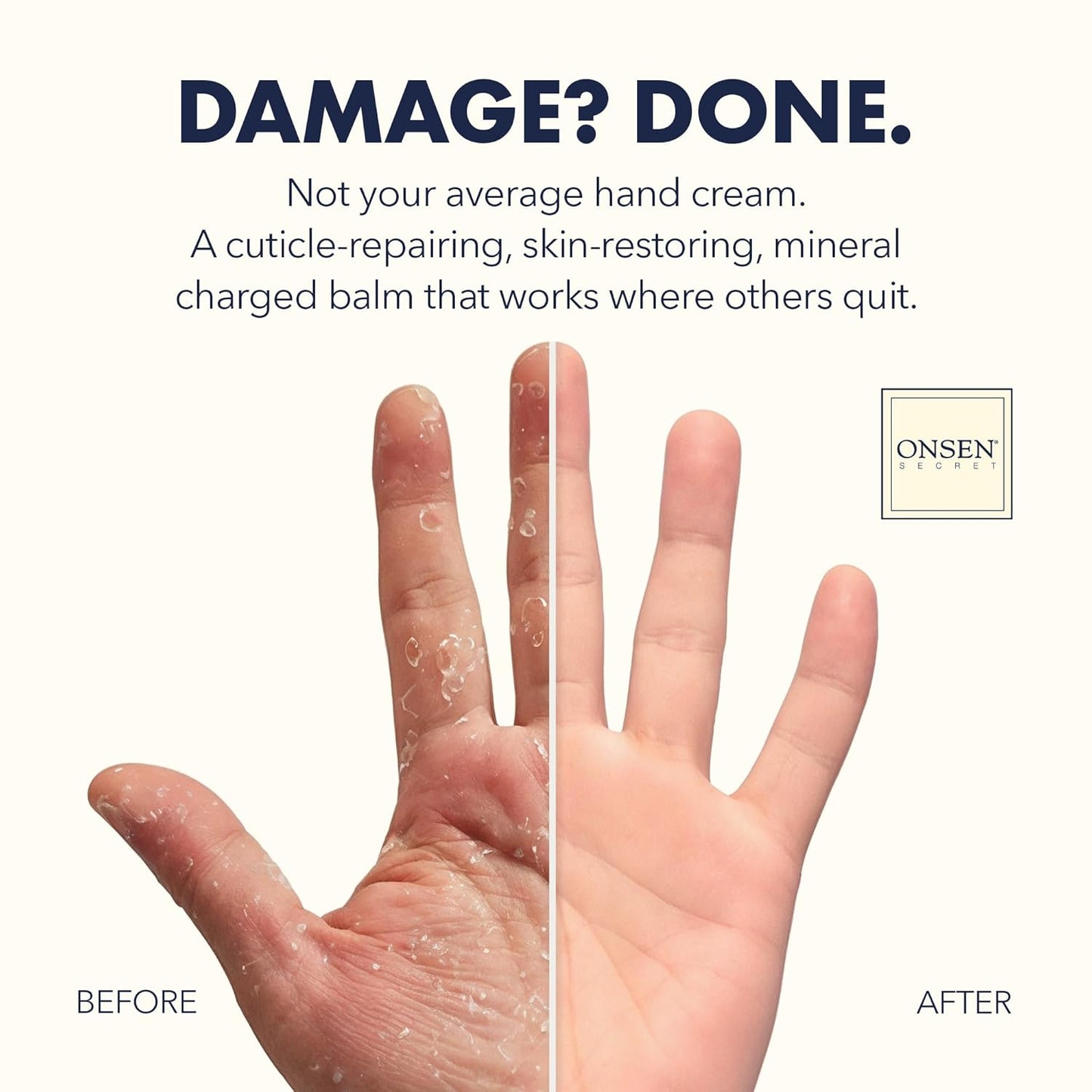 Onsen Hand & Cuticle Rescue Cream | Organic Nail Strengthener & Balm | Dry, Cracked Hands, Elbows & Feet | Shea Butter, Tsubaki & Jojoba Oil | Nail Repair & Growth, Vegan - 1 Pack (0.88 oz)