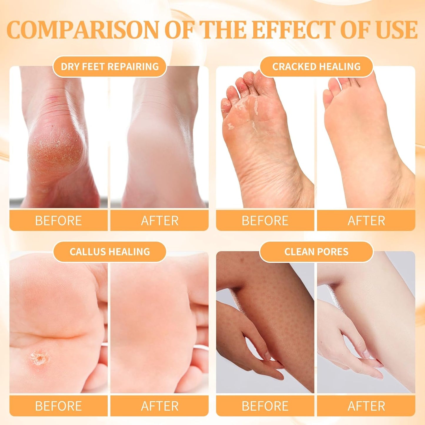 Foot Pedicure Spa Set,Foot Soak Spa Home Pedicure Kit with Bath Salt, Moisturizing Foot Scrub Cream Lotion, Foot Care for Dead Skin, Dry Cracked Feet, Make Baby Soft Feet, 3 Set