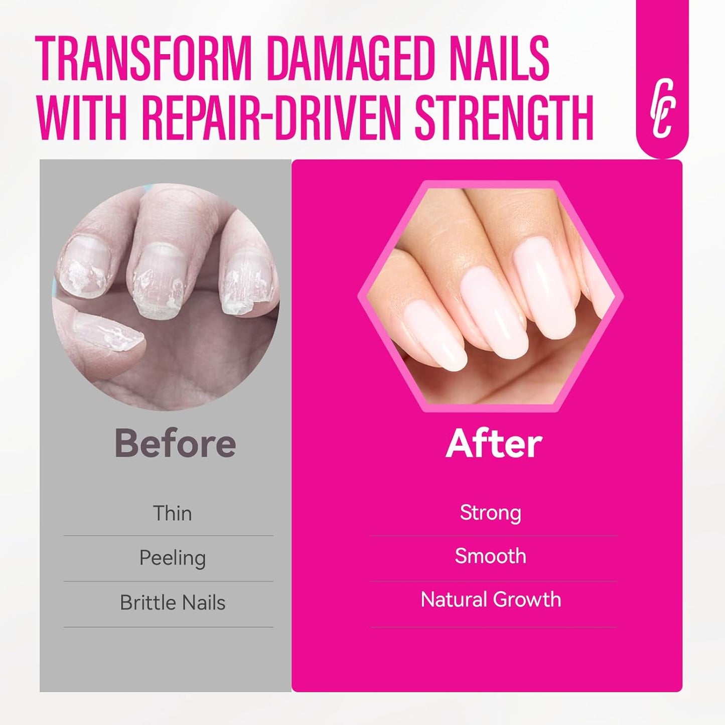 Nail Ridge Filler Hardener for Women: 15ml Milky White Nail Strengthener Protein Extra Strong and Growth - Polish Concealer for Thin and Damaged Nails