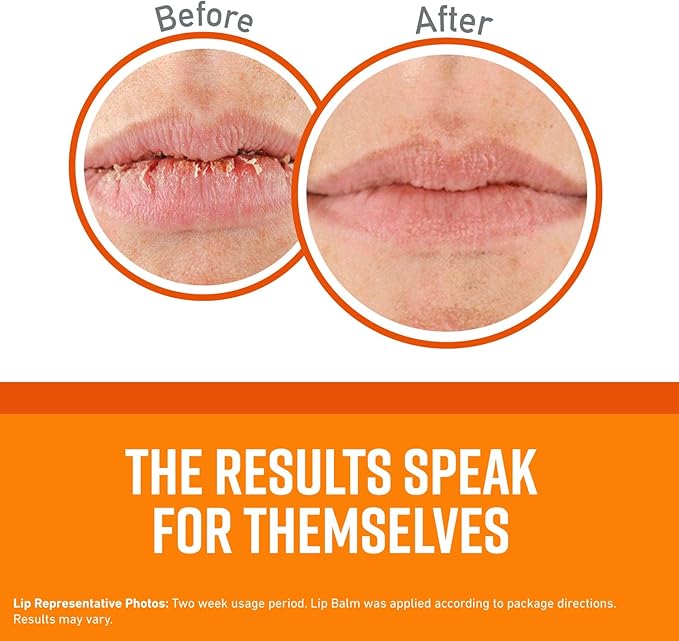 O'Keeffe's Unscented Lip Repair Lip Balm for Dry, Cracked Lips, Stick, (Pack of 6)