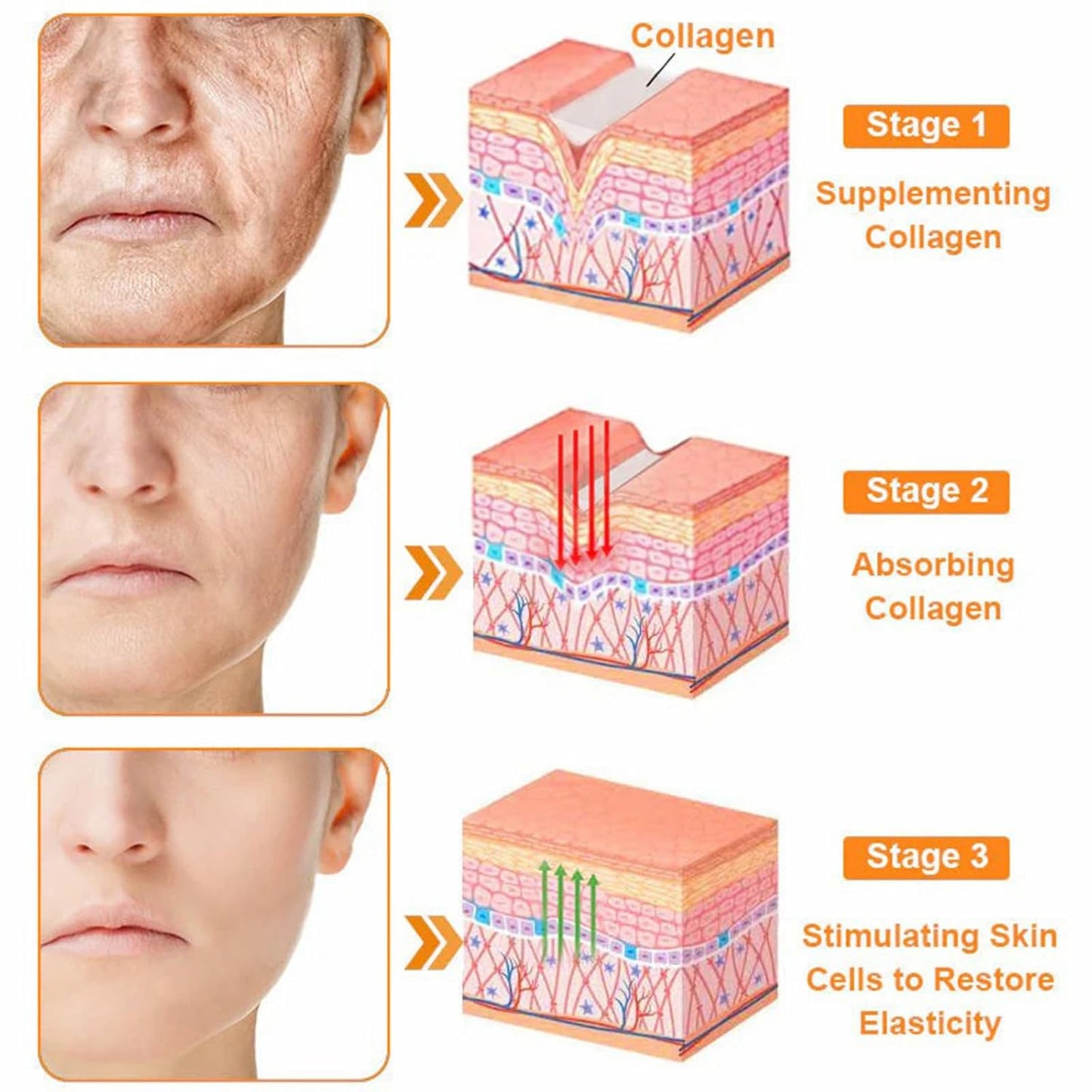 LipMaps Bee Venom skin Restoration Cream,Bee Venom Skin Treatment Cream,Deeply Moisturizing and Firming for All skin Types (4PCS)