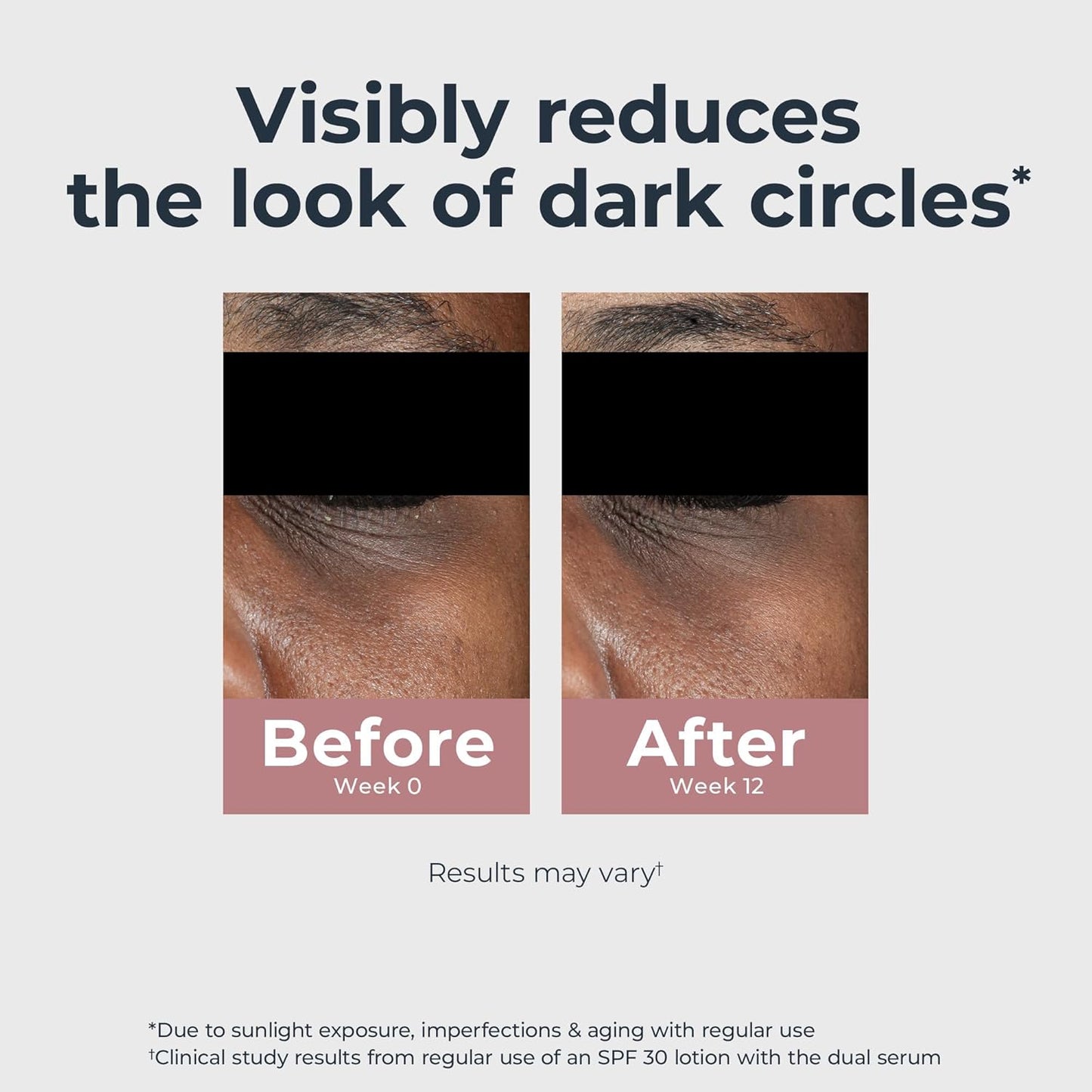 Eucerin Radiant Tone Eye Cream Dark Circle Corrector, Eye Brightening Cream with Thiamidol and Hyaluronic Acid, Helps Reduce the Look of Eye Puffiness, 0.5 Oz Tube