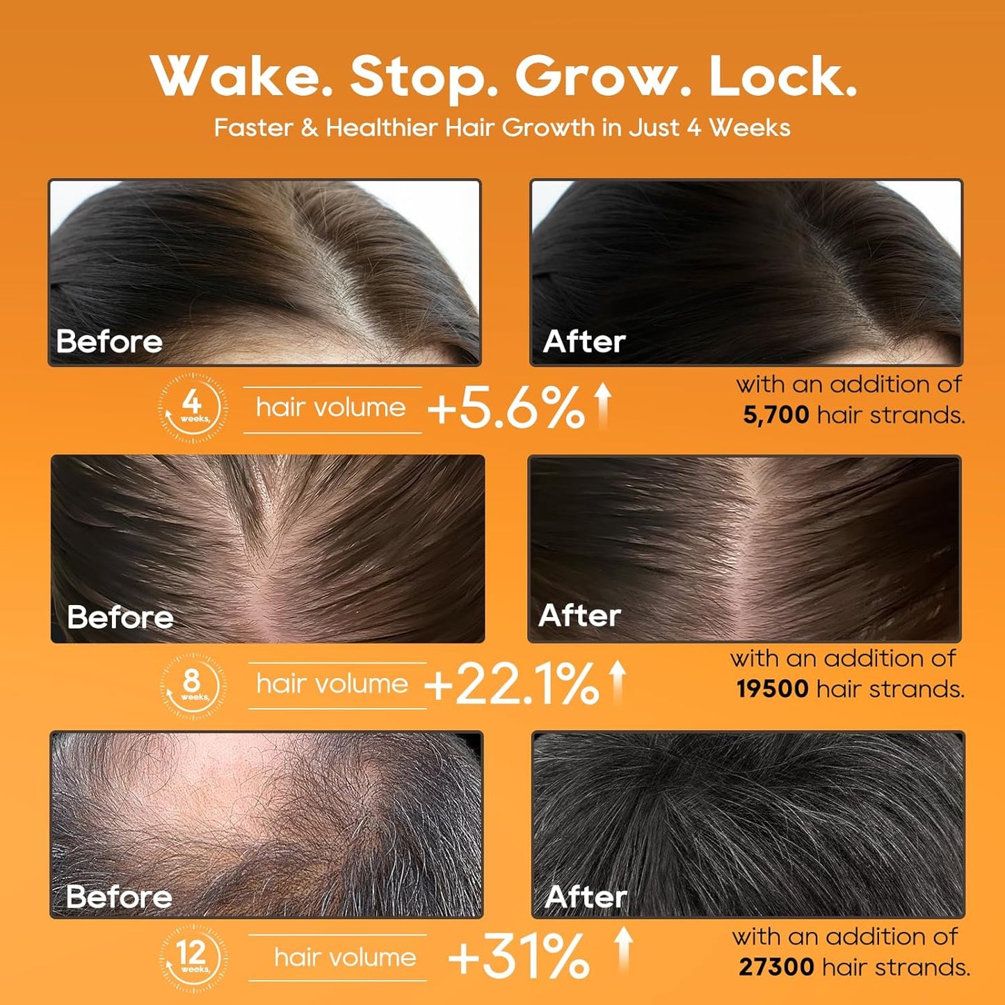 Women‘s Hair Growth Serum Oil, 100% Veganic Natural Herbal Extracts, Root Revive Visibly Thickening Fuller Hair, Follicle Stimulator Scalp Serum for Hair Loss/Shedding,Thin, Dry & Damaged Treatment