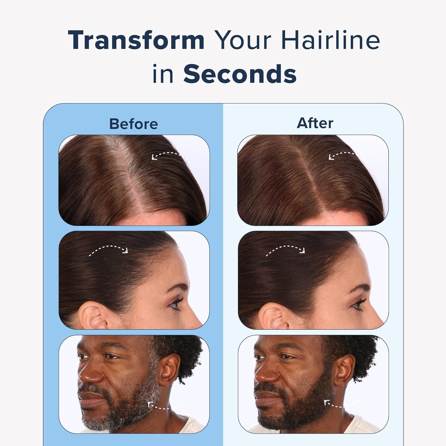 TRUHAIR Color & Conceal Waterproof Root Touch Up Hair Color Concealer - Hair Cover up for Gray Coverage and Hairline Filling - 11 Hair Colors Available (Dark Brown)