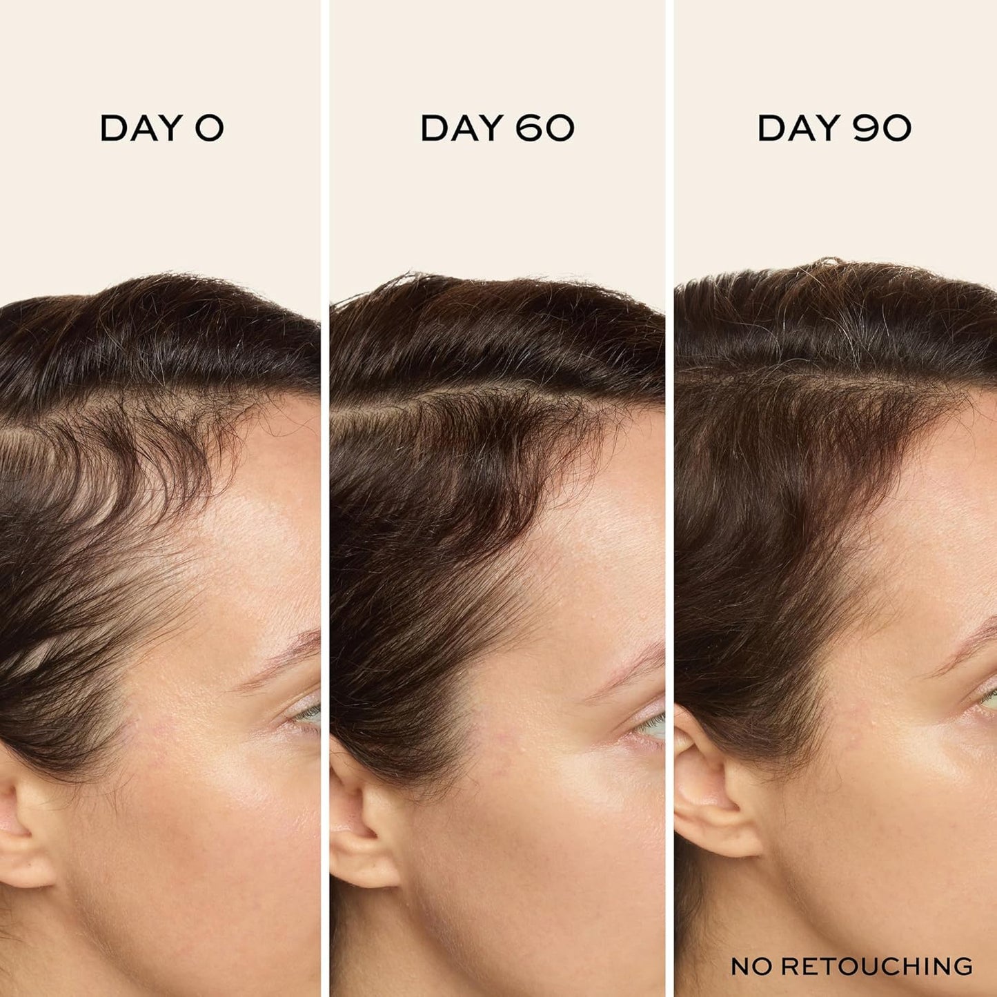 John Frieda ULTRAfiller+ Hair Density Scalp Serum for Fine Hair, Volumizing Hair Serum, Scalp Treatment for Thickening for Women and Men, 2 Oz