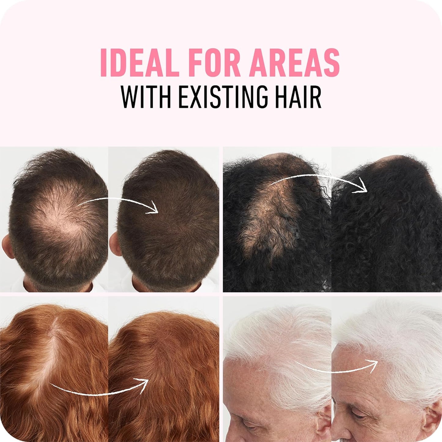 BOLDIFY Hair Fibers (28g) - Fill In Thinning and Fine Hair for an Instantly Fuller, Thicker Look - 14 Shades for Women & Men - Dark Gray