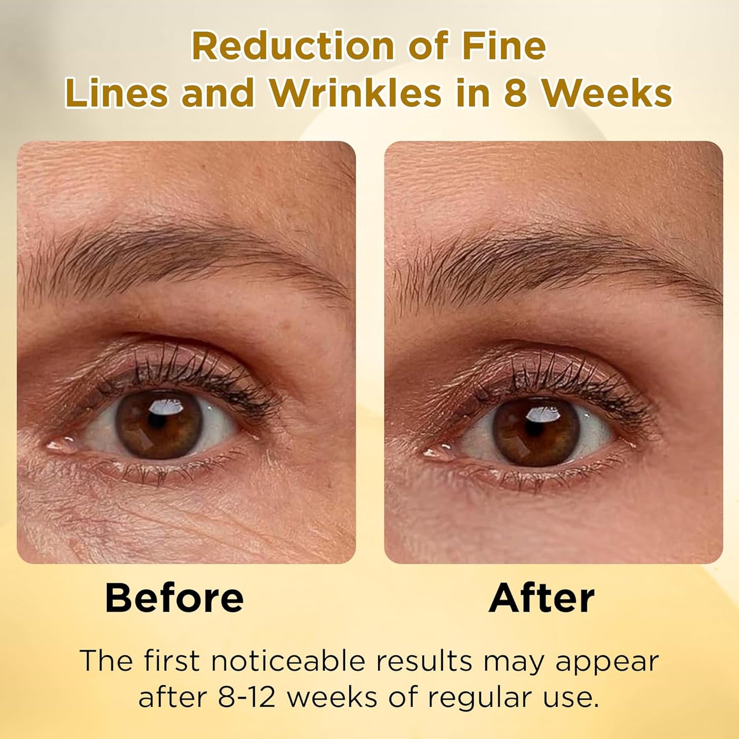 LADY NADA Retinol Eye Serum – Anti-Aging Night Treatment with Collagen, Vitamin E & Natural Extracts – Smooths Fine Lines, Deeply Hydrates, Long-Lasting Effect – For All Skin Types – 1.0 fl oz