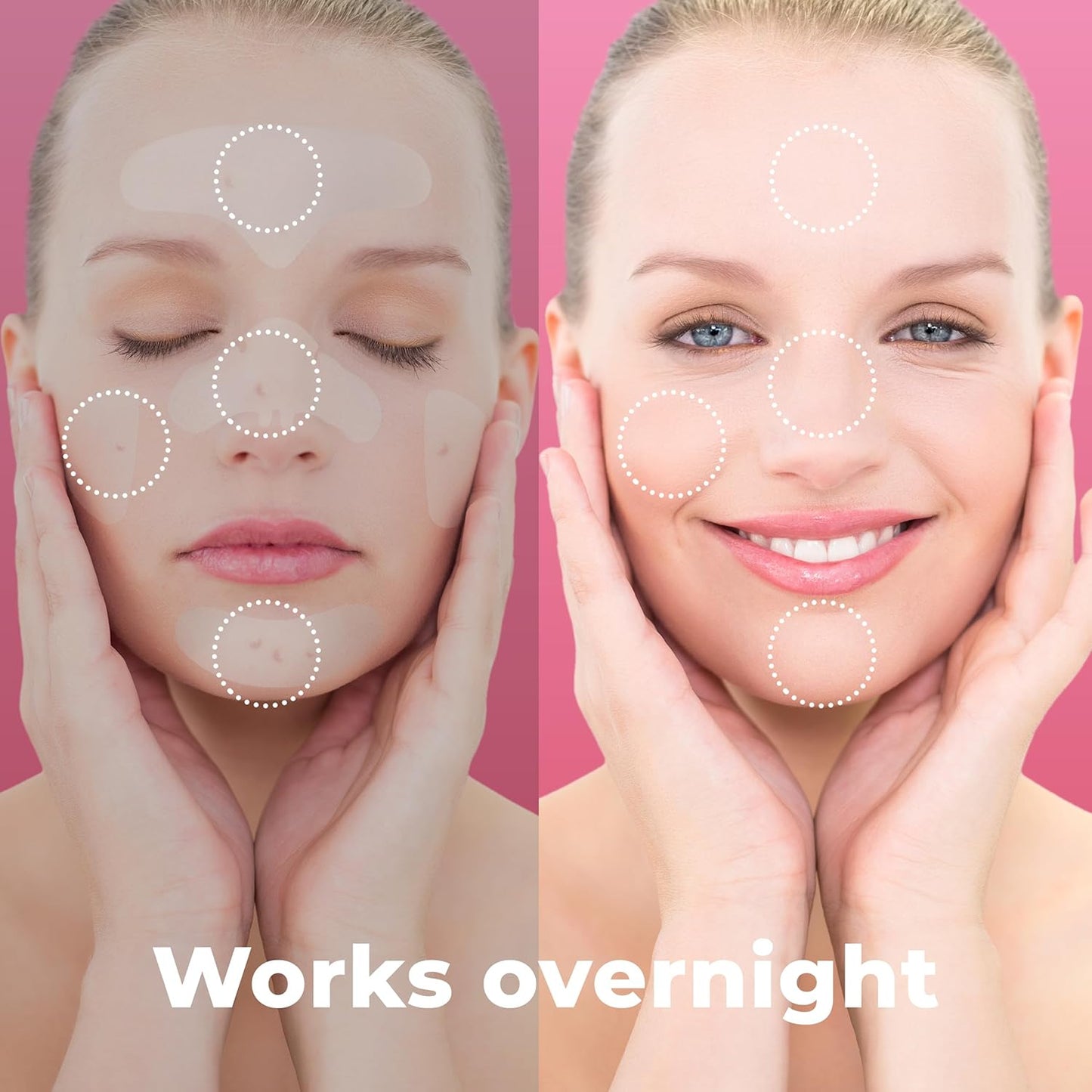 Full Face Pimple Patches (5 Sets), Reduce Pimples On Whole Face Overnight, Hydrocolloid Acne Mask, Pimple Patches, Large Acne Patches, Full Face Hydrocolloid Mask