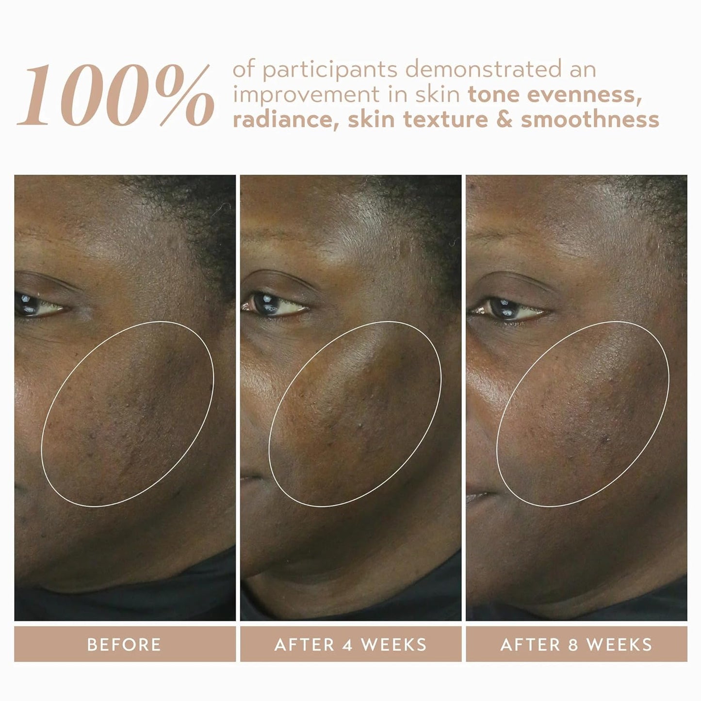 SHANI DARDEN SKIN CARE Retinol Reform with 1% Encapsulated Retinol Serum for Face & Neck, Gentle Slow-Release Face Serum with Tripeptide for Wrinkles, Fine Lines & Uneven Tone, 1 fl oz