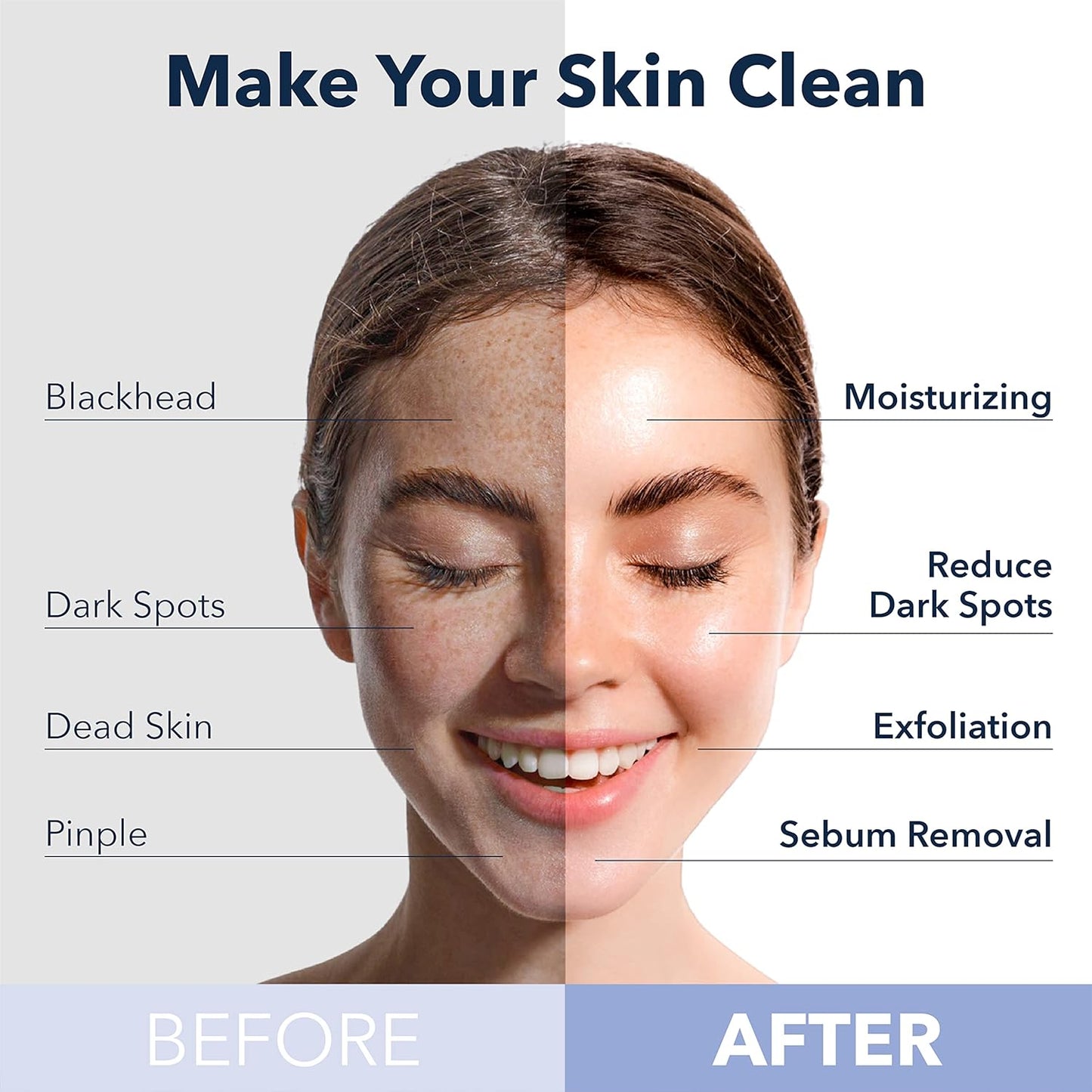 Purederm Deep Purifying Pink O2 Bubble Mask Peach (5 Pack) – Bubble Face Sheet Mask for Purifying & Moisturizing