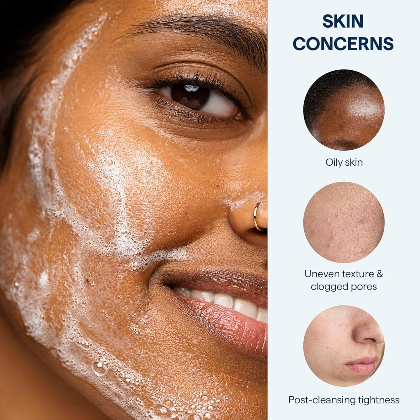 Remedy for Lightweight Cleansing - Gel to Foam Cleanser for Normal to Oily Skin - 0.5% Salicylic Acid, Ceramides, Glycerin, Green Tea - By Dermatologist Dr. Shah, 5 fl. Oz