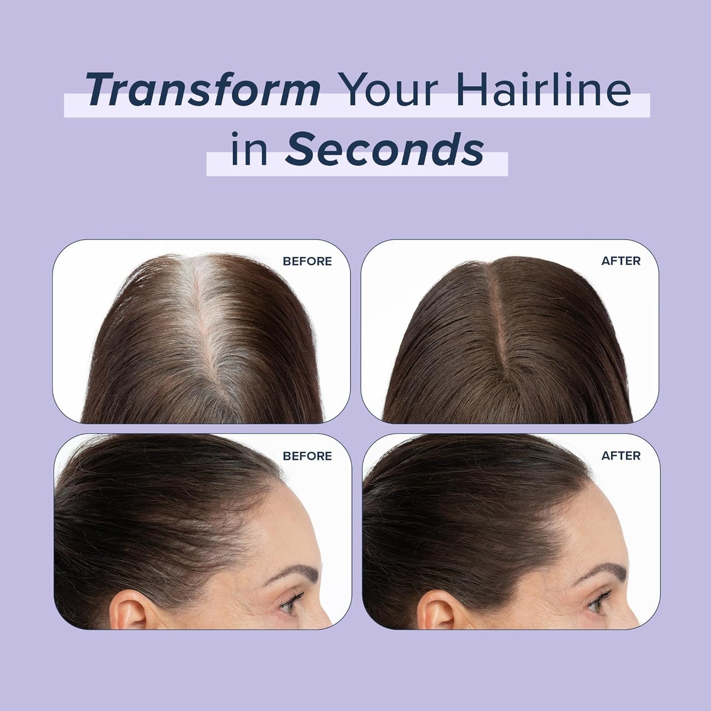 TRUHAIR Root & Scalp Cover Up Pressed Powder Compact, Waterproof, Weightless Hair Coverage & Bald Spot Concealing, Root Touch Up Hair Color for Gray Coverage & Thinning Areas, 0.35 Oz (Gray)