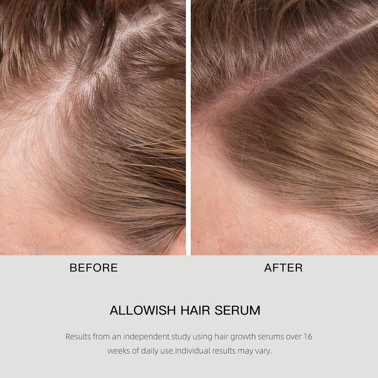 Hair Growth Serums 95 ml - Rosemary Hair Thickening Serum with Biotin, Caffeine for Hair Thinning & Shedding – Promotes Healthy Scalp, Fuller, Nourish, Strengthens Roots