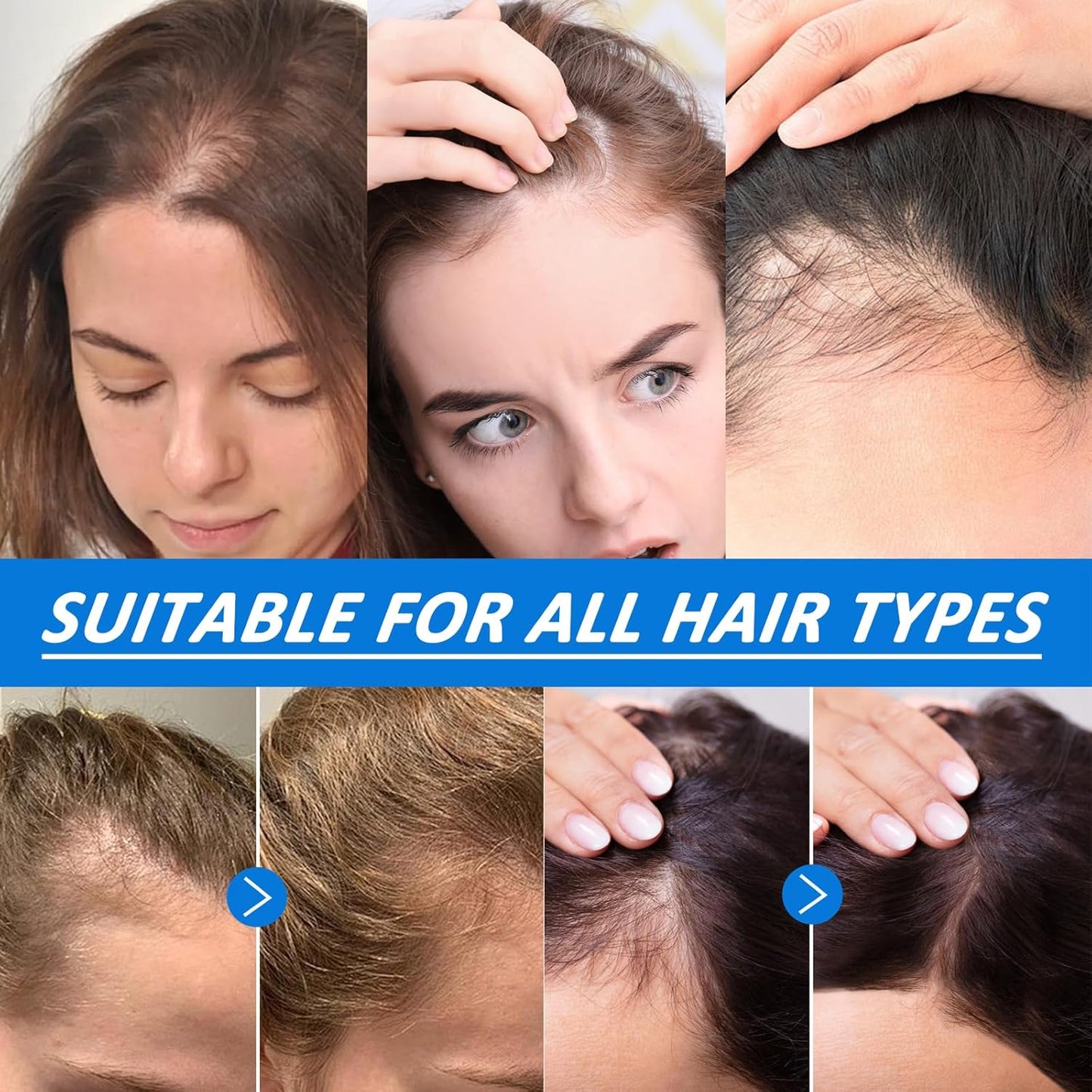 Ovela Hair Ampoule Serum, Scalpy Hair Growth Serum for Hair Loss & Thinning | Hair Growth Serum Women & Men w/Salicylic Acid, Menthol, Dexpanthenol | Non-Greasy, Lightweight (1 PCS)