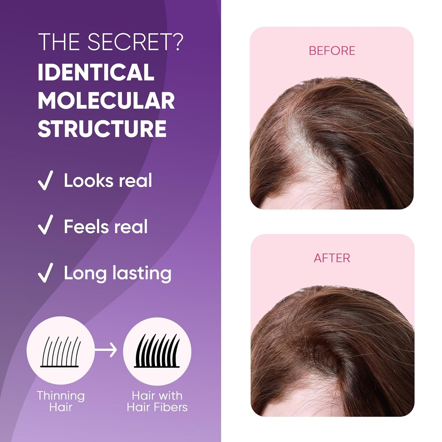 GBG Hair Fibers for Thinning Hair & Bald Spots (Medium Brown) - 25g Bottle - Conceals Hair Loss - Instant Cover Up & Volume in 30 Seconds, Hair Powder for Women & Men - Cruelty Free